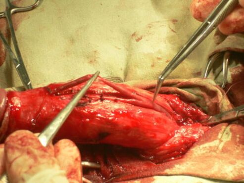 Performs penis enlargement surgery